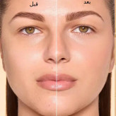 تینت پوست شیگلم