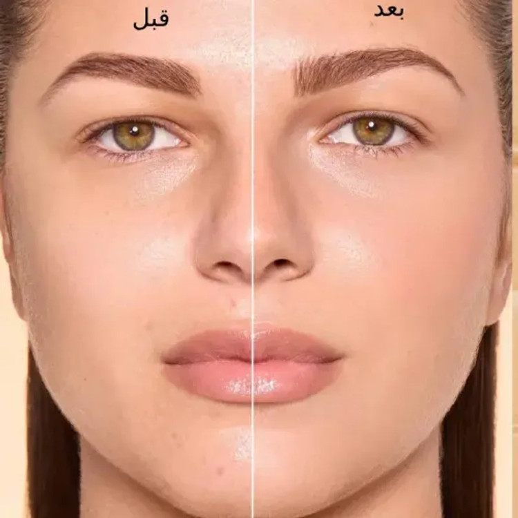 تینت پوست شیگلم